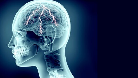 X-ray illustration of a human head with migraine