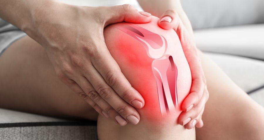Woman holding her knee in pain