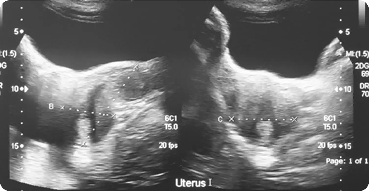 Photo of ultrasound