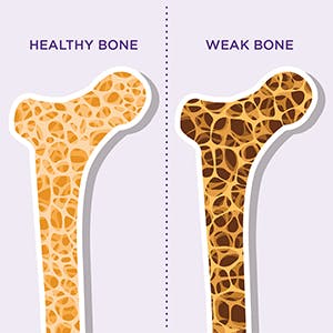 Bone