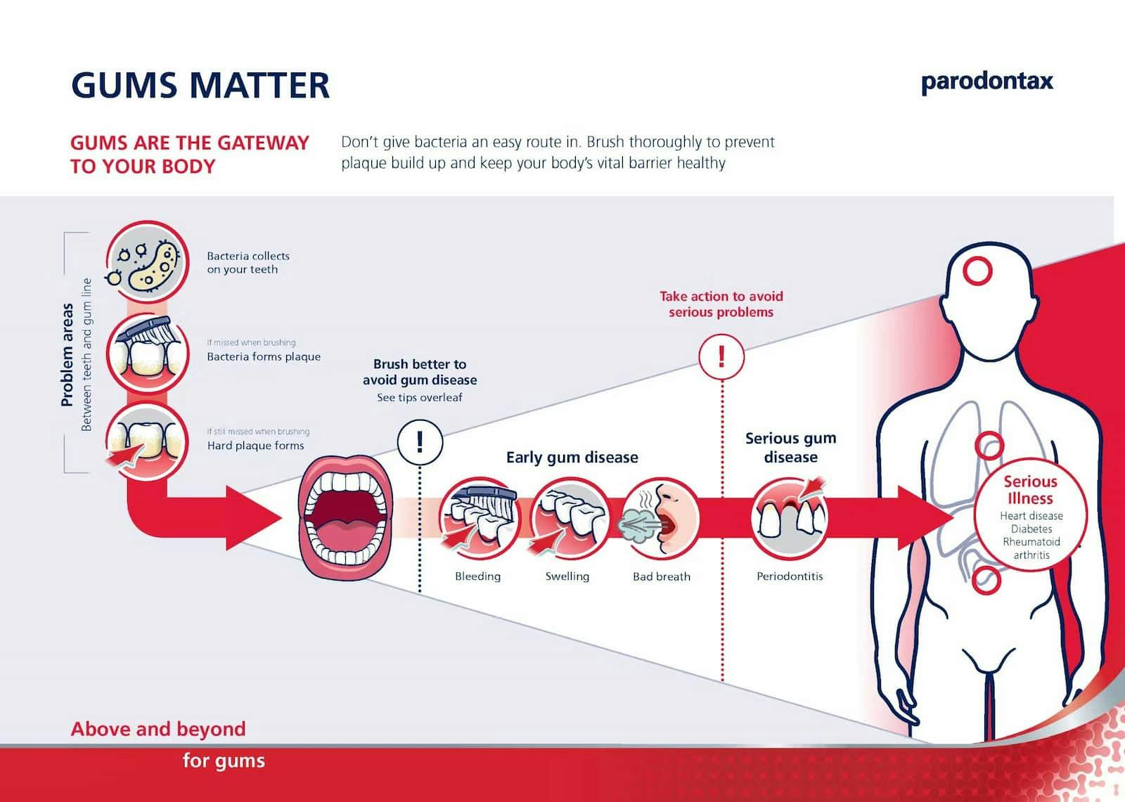 Gums matter