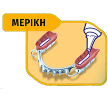 MEPIKH