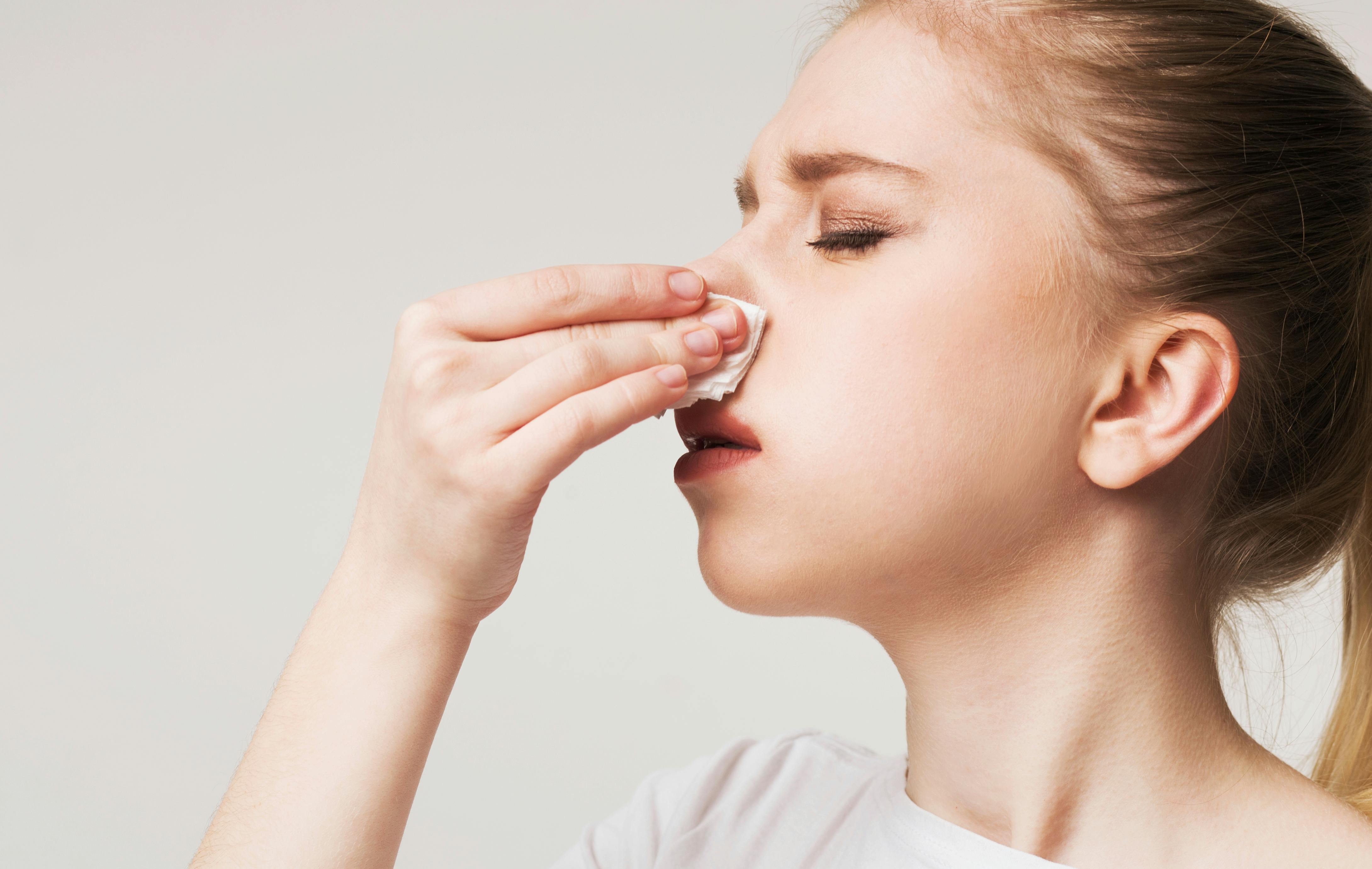 Young woman blowing her nose due to allergies 