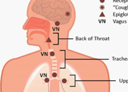 Why Do We Cough? Why Do We Cough?