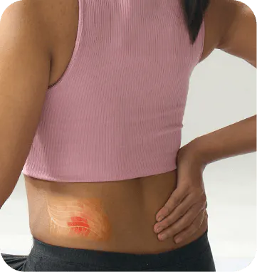 Back Pain