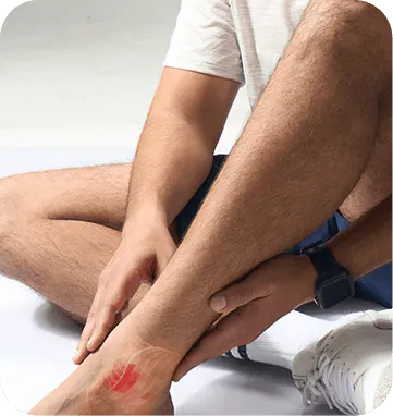 Sprains and strains
