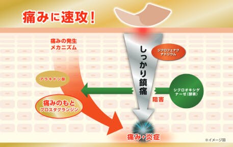 ボルタレン テープ 安い 効果