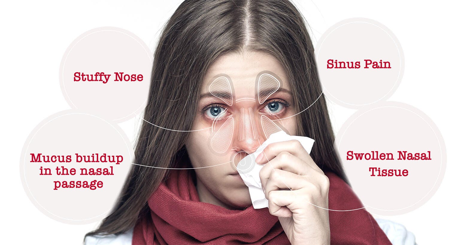 Nasal and sinus congestion new arrivals