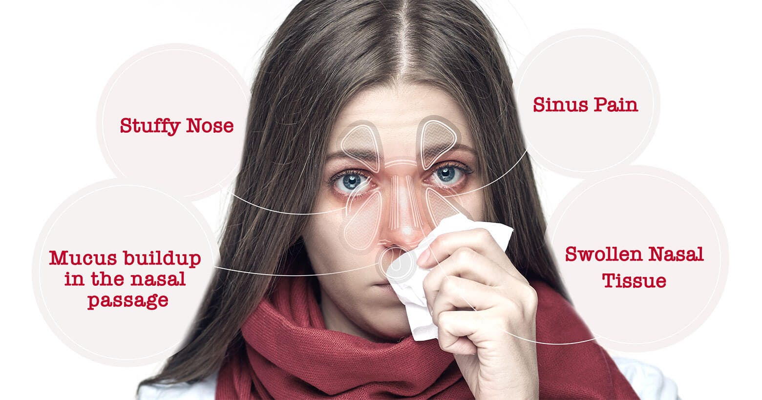 Woman with nasal congestion symptoms