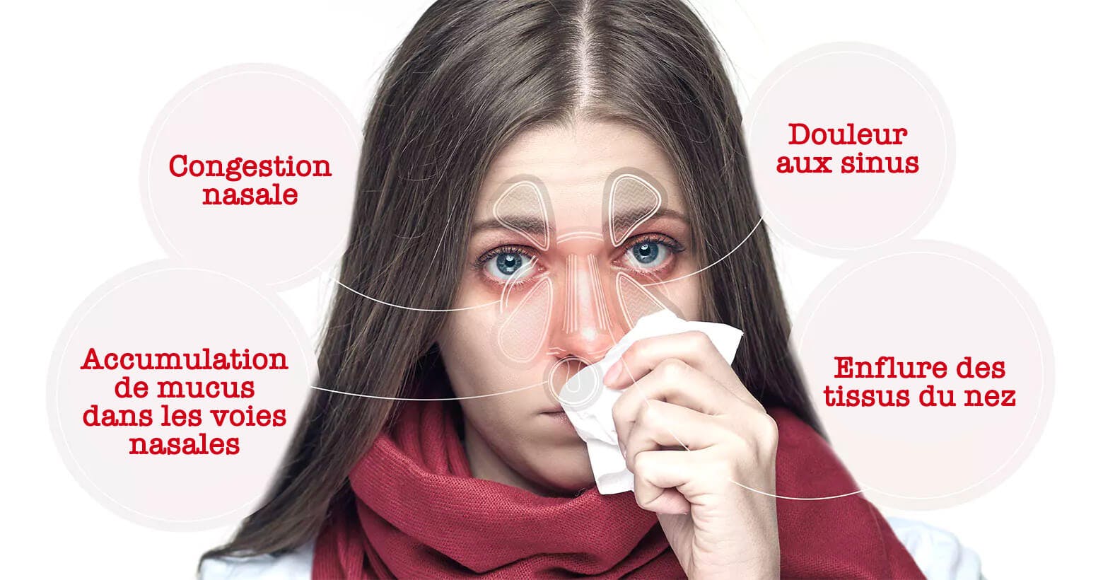 Femme atteinte de symptômes de la congestion nasale