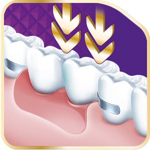 pressing down the dentures