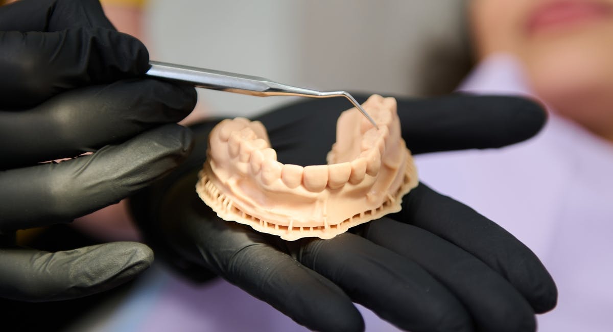 A hand holding a plaster model of teeth