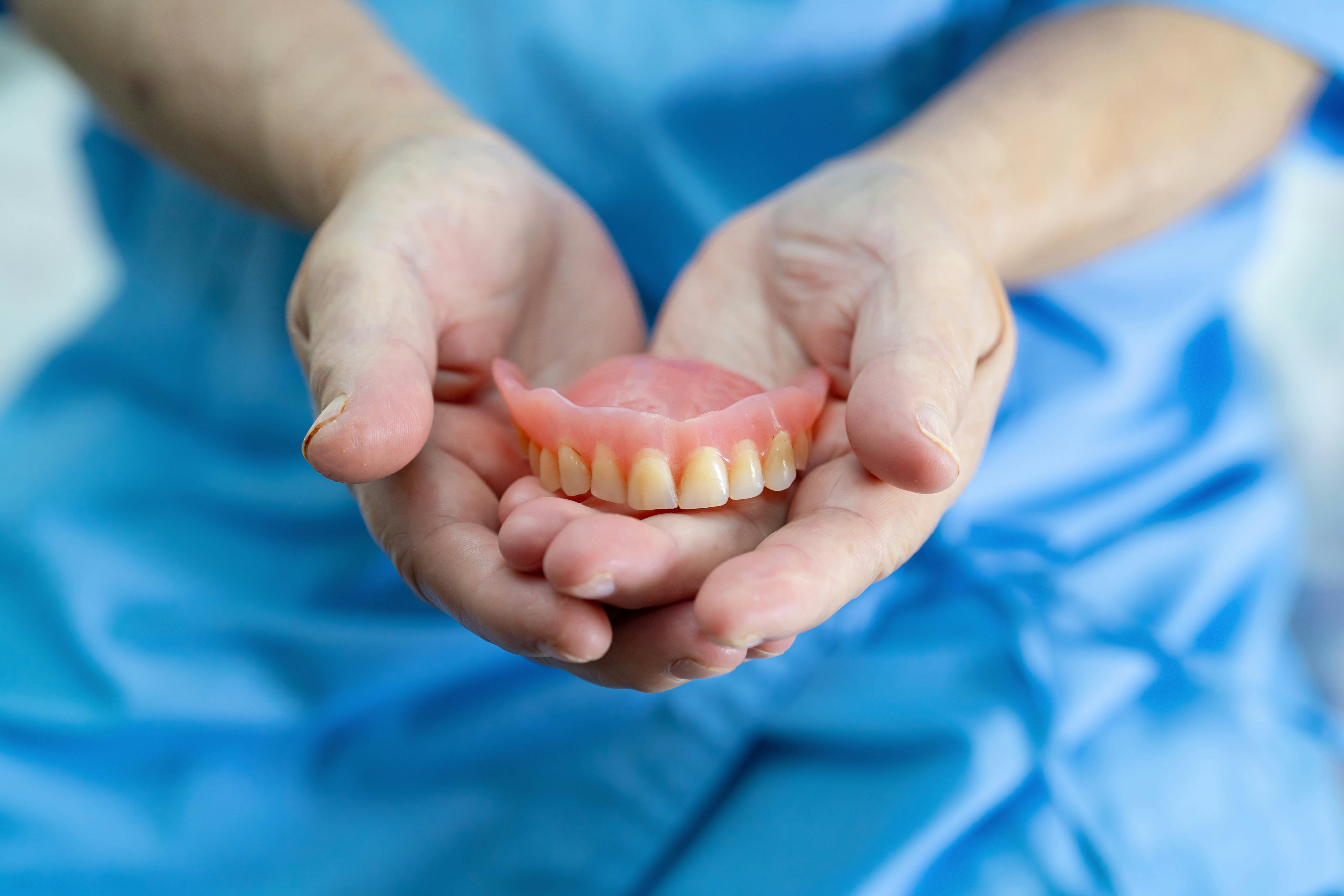 Patient dentures in palm of hand