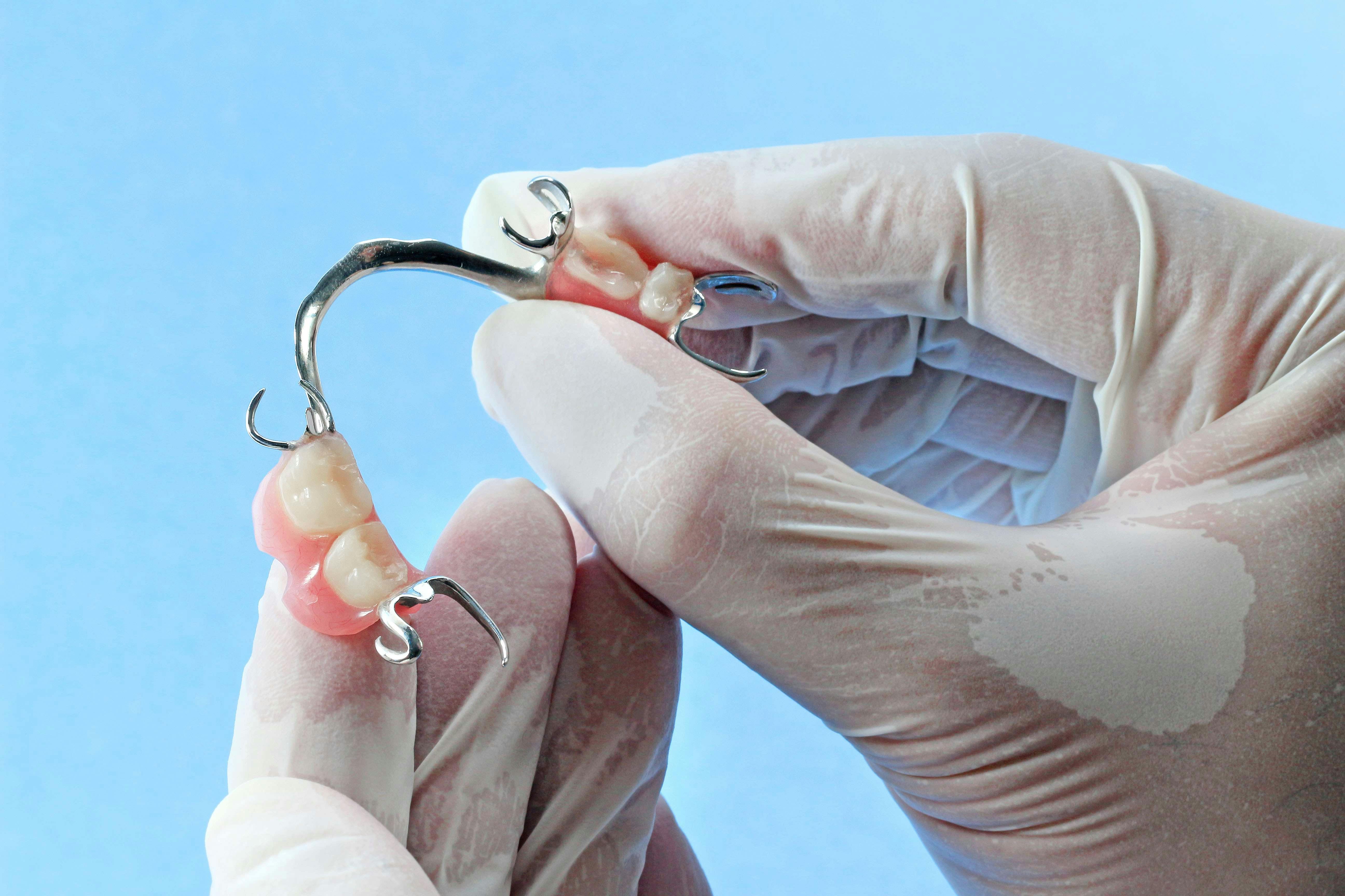 Dentist holds partial dentures for back teeth