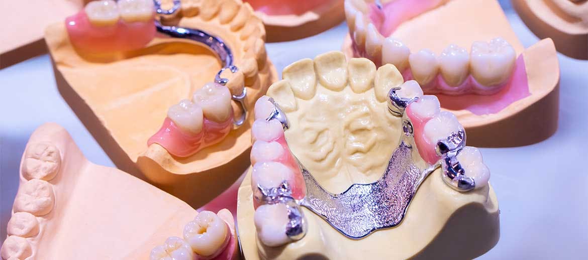 Different types of partial dentures on a table