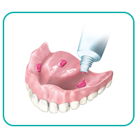 putting adhesive cream on upper dentures