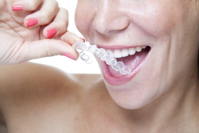 woman putting her retainer