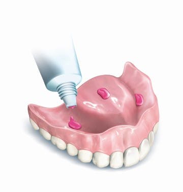 putting adhesive cream on upper dentures