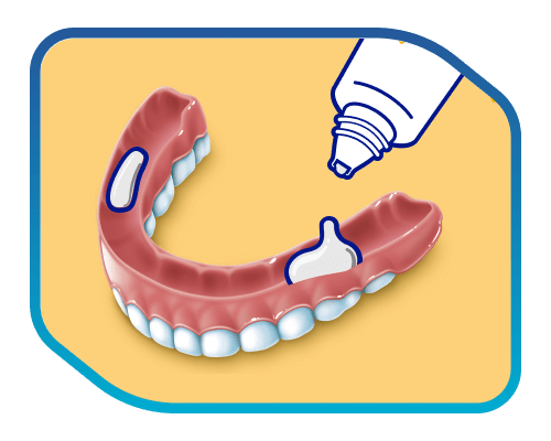 putting adhesive cream on lower dentures