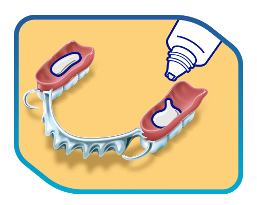 putting adhesive cream on partial dentures