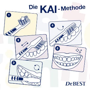 Die KAI-Methode, eine Zahnputztechnik für Kinder in 5 Schritten