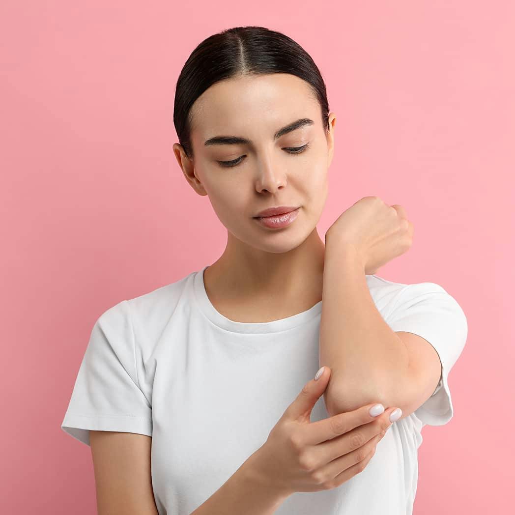 What are hives symptoms