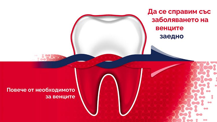 Флуоридната паста за зъби parodontax помага за предотвратяване и лечение на кървене на венците и справяне с гингивит.