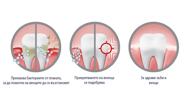 Графика, показваща как parodontax Active Gum Repair премахва бактериите от плаката, стяга венците и помага за здравето на зъбите и венците
