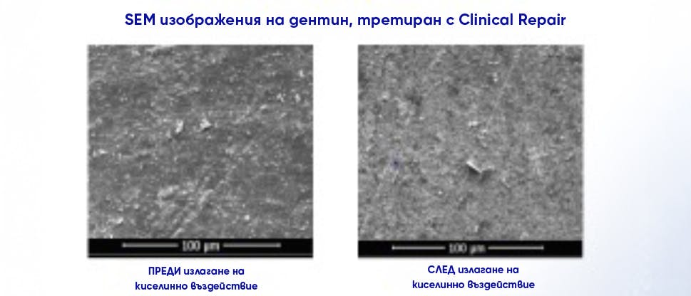 Изображения на дентин, третиран с паста за зъби Sensodyne Clinical Repair, преди и след киселинно излагане, за да се покаже резистентност