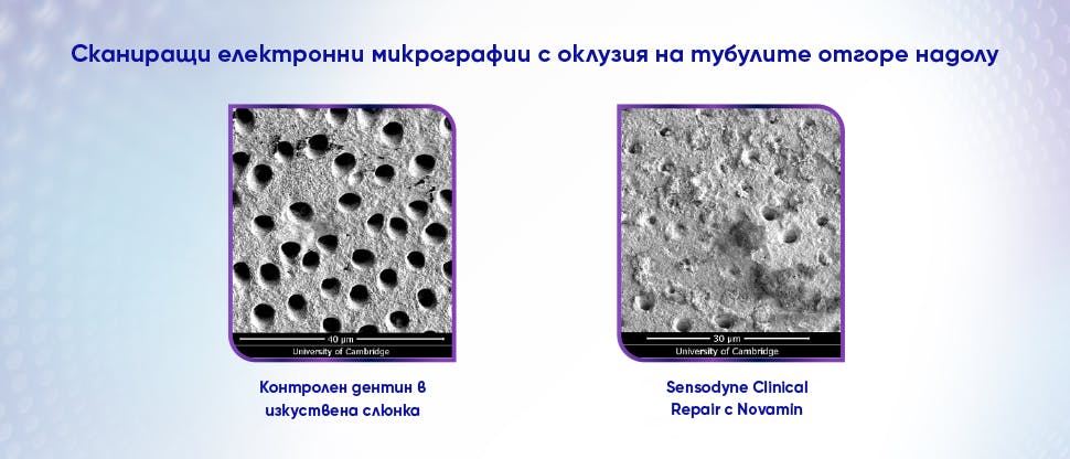Изображение на дентиновите тубули след третиране с паста за зъбиw