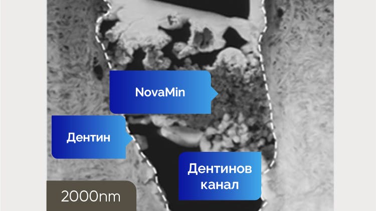 Получено от TEM изображение на дентин при 2000 nm 