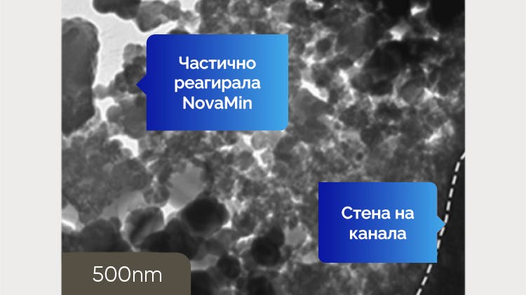 Получено от TEM изображение на дентин при 500 nm