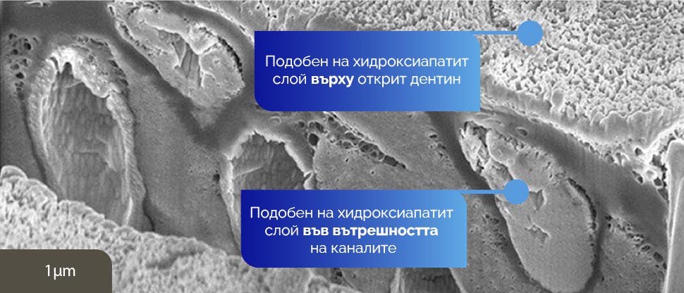 Получено от SEM изображение на слой, подобен на хидроксиапатит, върху открит дентин