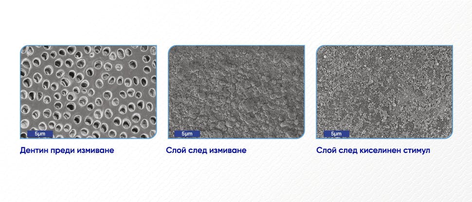 Изображения на дентинова повърхност, получени от сканиращ електронен микроскоп (SEM)  
