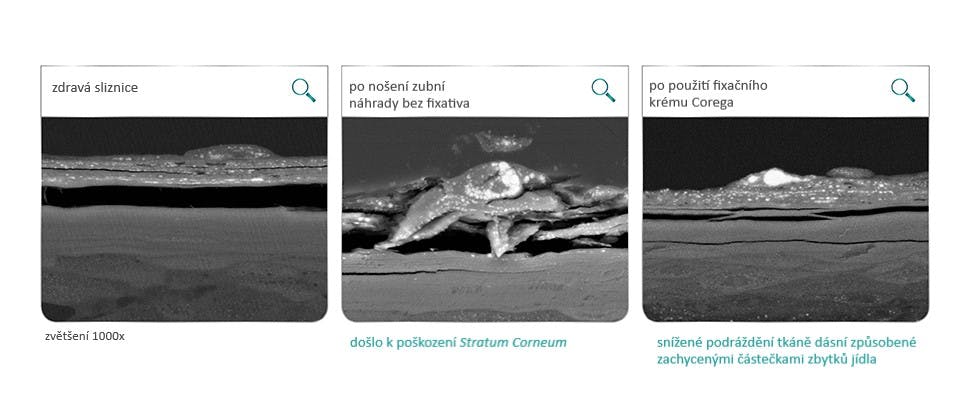 Sliznice ústní dutiny po 12 hodinách od podráždění mákem a akrylátovými disky v laboratorních testech