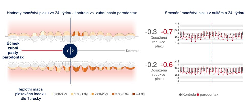 Obrázek interaktivní mapy úst zobrazující redukci plaku po použití zubní pasty s hydrogenuhličitanem sodným