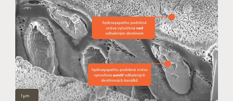 SEM snímek hydroxyapatitu-podobné vrstvy