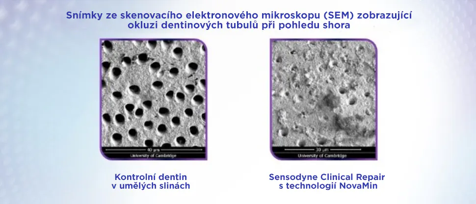 Snímek dentinových tubulů po ošetření zubní pastou