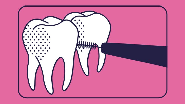 Zwei Zähne Zahnzwischenraum putzen