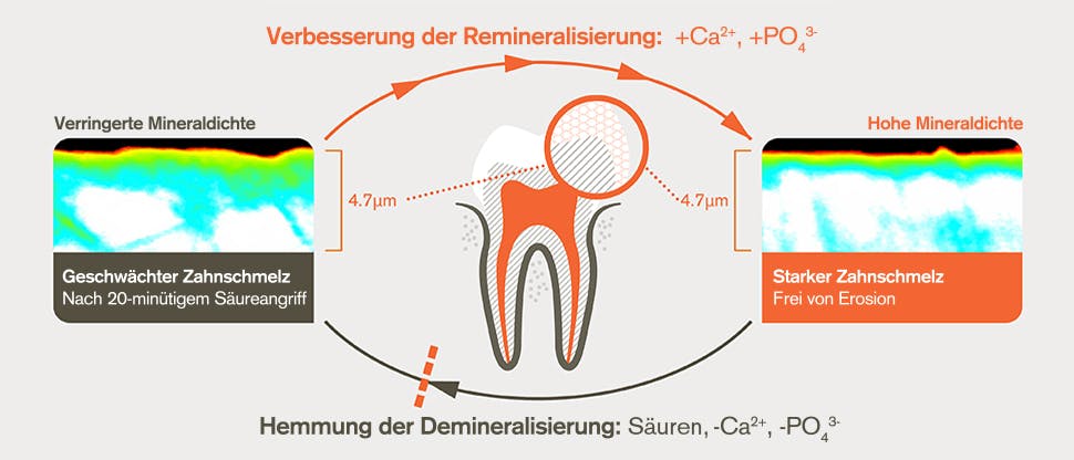 Remineralisierungs- und Demineralisierungsprozess nach 20-minütigem Säureangriff