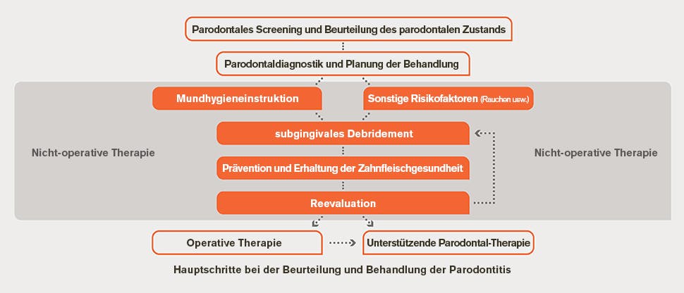Flussdiagramm für die Beurteilung und Behandlung der Parodontitis