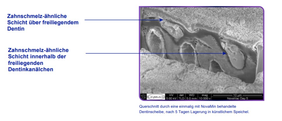 Querschnitt durch eine einmalig mit NovaMin behandelte Dentinscheibe