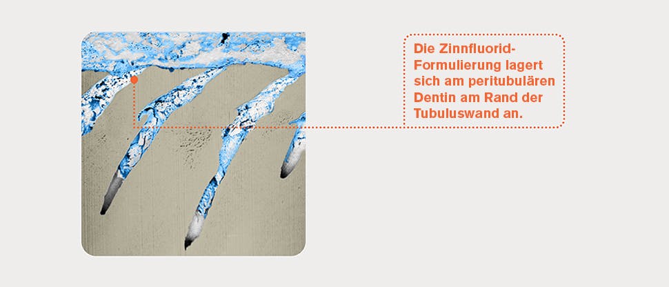 Repräsentatives FIB-SEM-Bild von Dentintubuli