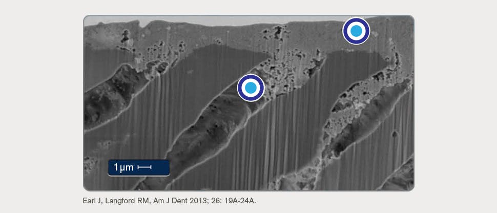 in vitro SEM-Bild eines Dentin-Querschnitts