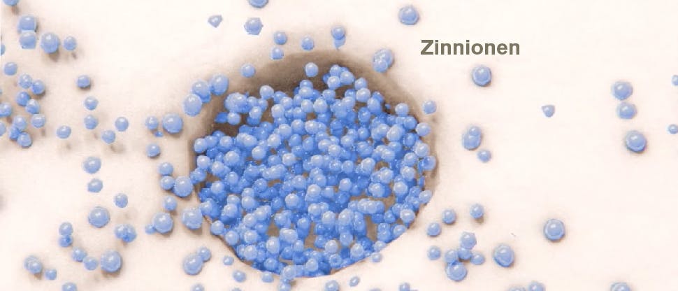 Eine Zinnfluorid-haltige Schicht auf freiliegendem Dentin