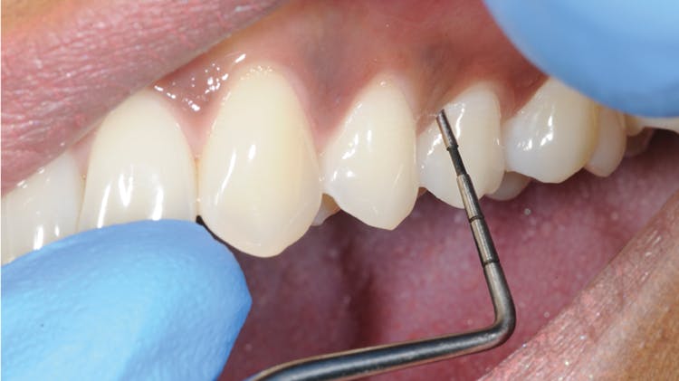 Ασθενής που βρίσκεται υπό εξέταση των ούλων του