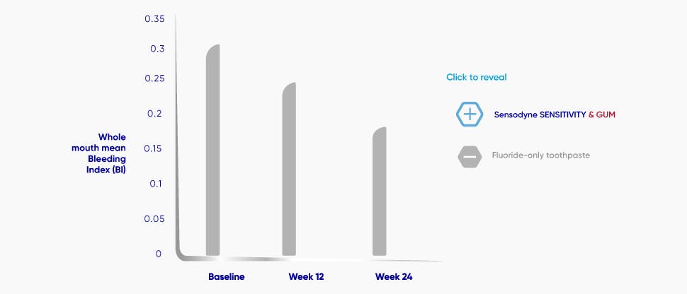 Γράφημα υγείας των ούλων της Sensodyne