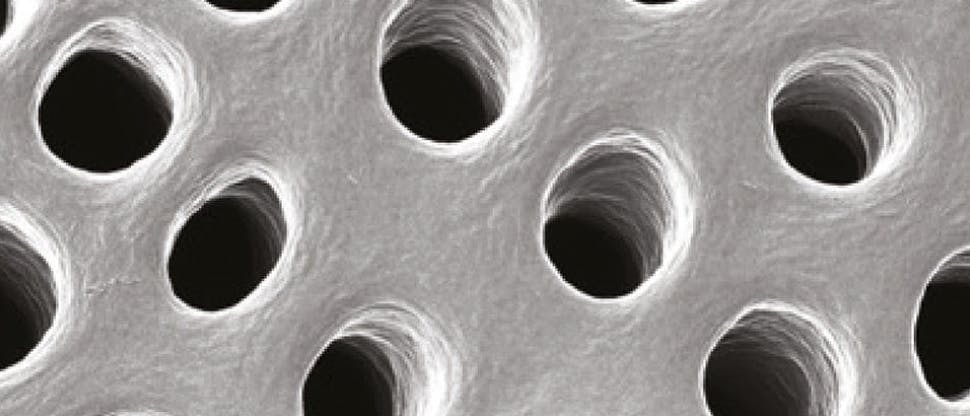 Εκτεθειμένα οδοντινοσωληνάρια