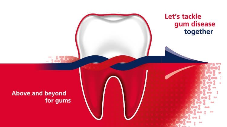 Icon of tooth showing how parodontax is helping to tackle gum disease.