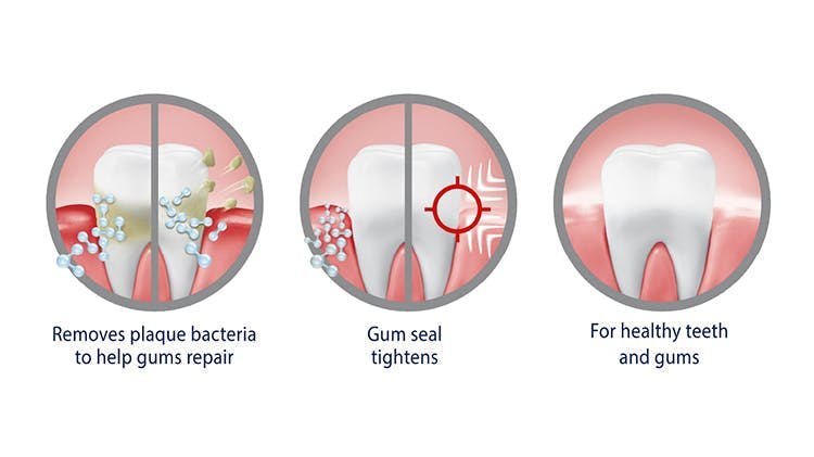 Graphic showing how parodontax Active Gum Repair removes plaque bacteria, tightens the gum seal and helps with teeth and gum health